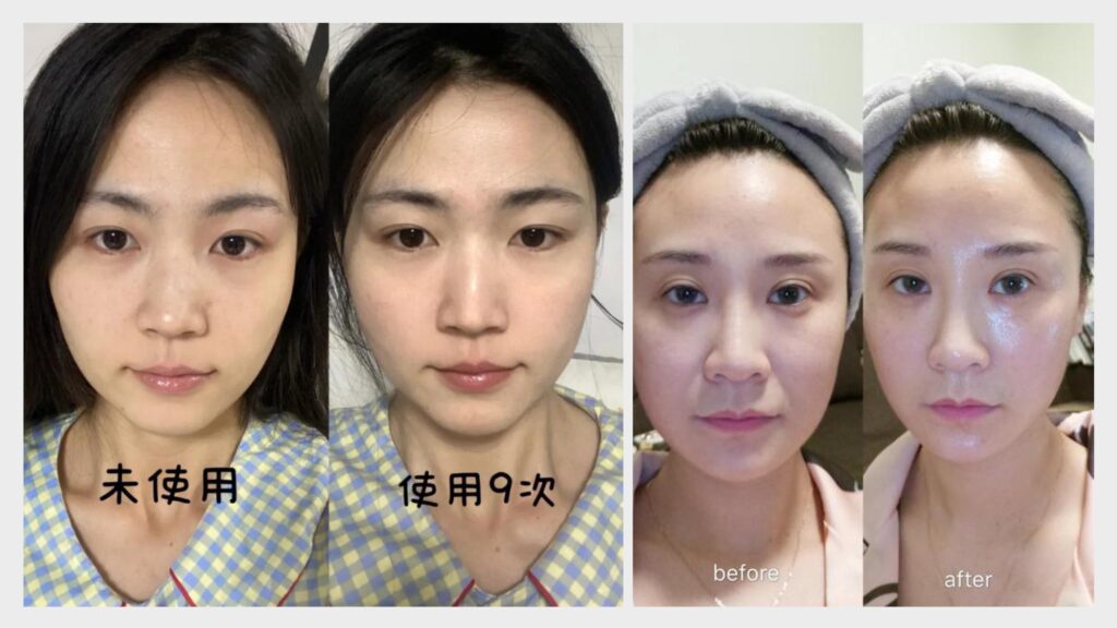 p90太赫茲兆能儀, P90足墊熱儀